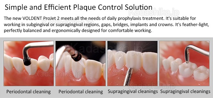 Voldent ProJet 歯面清掃器 エアフローデバイス（歯肉縁上 + 歯周ハンドピース）